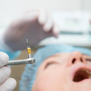 A patient undergoing dental implant surgery