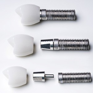 Dental implant parts