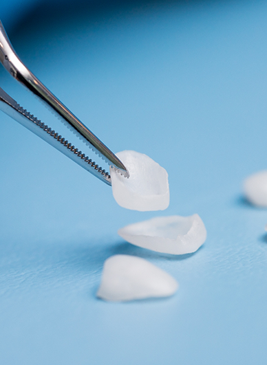 Tweezers holding a veneer