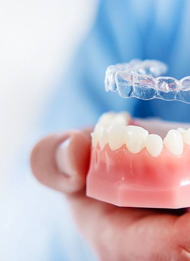 Dentist putting clear aligner on model of teeth